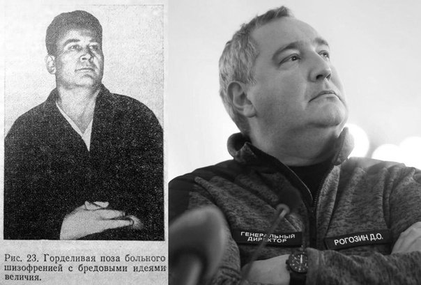 Поза человека с манией величия