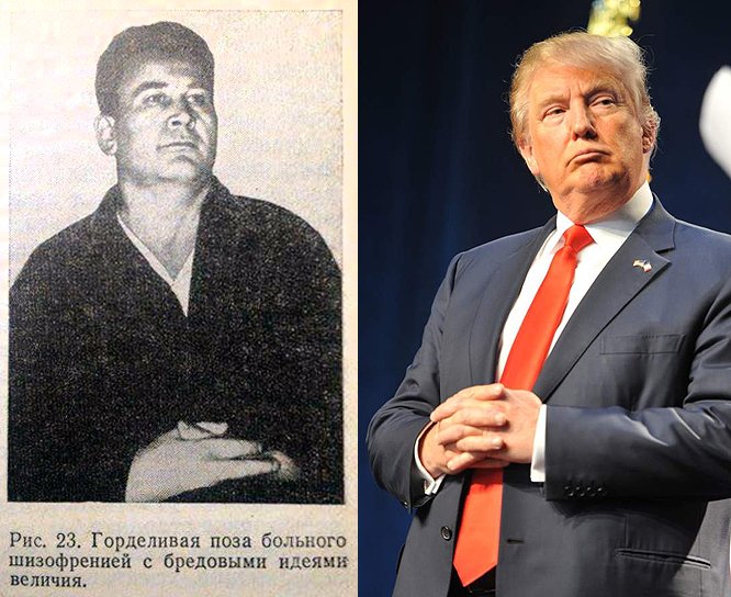 Больной шизофренией с бредовыми идеями величия