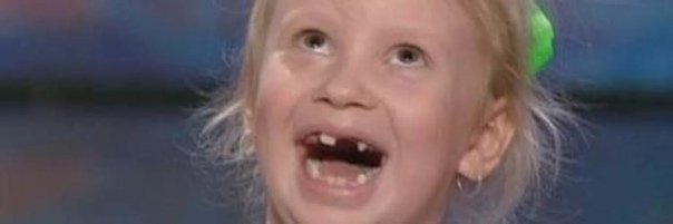 Беззубая девочка смеется