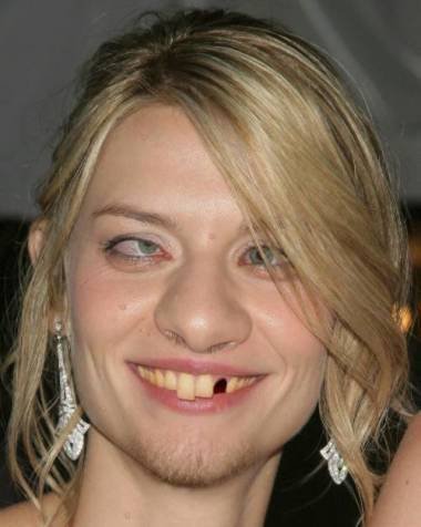 Беззубыезубые девушки