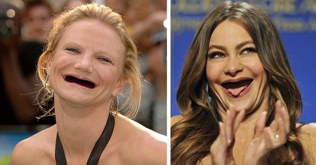 Зубы Камерон Диаз