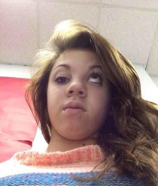 Мемы человека с косоглазием