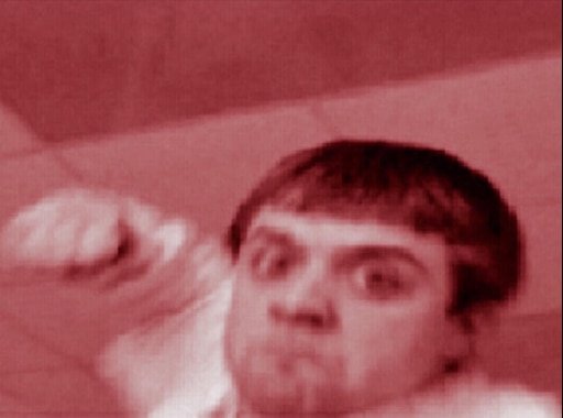 Интерны Лобанов бьет