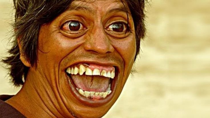 Дурацкая улыбка