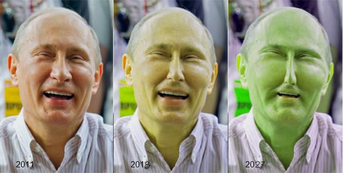 Ботокс Путин до и после