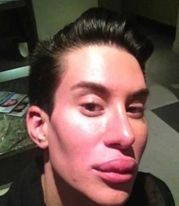 Пареньснакачеными губами