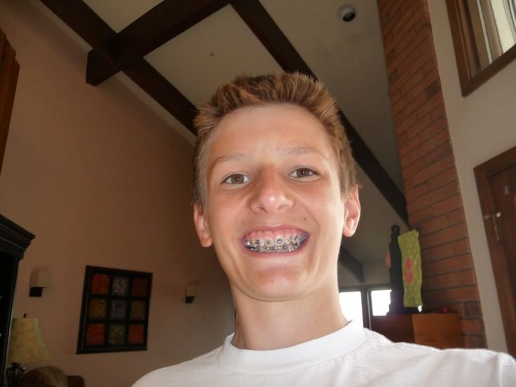 Парень с брекетами