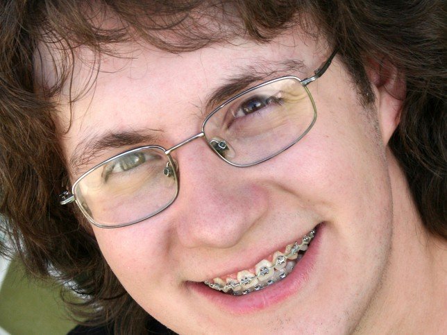 Люди с брекетами