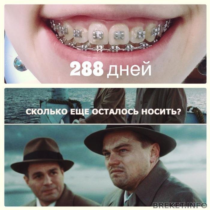 Брекеты приколы картинки