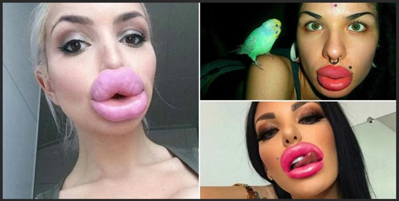 Силиконовые губы