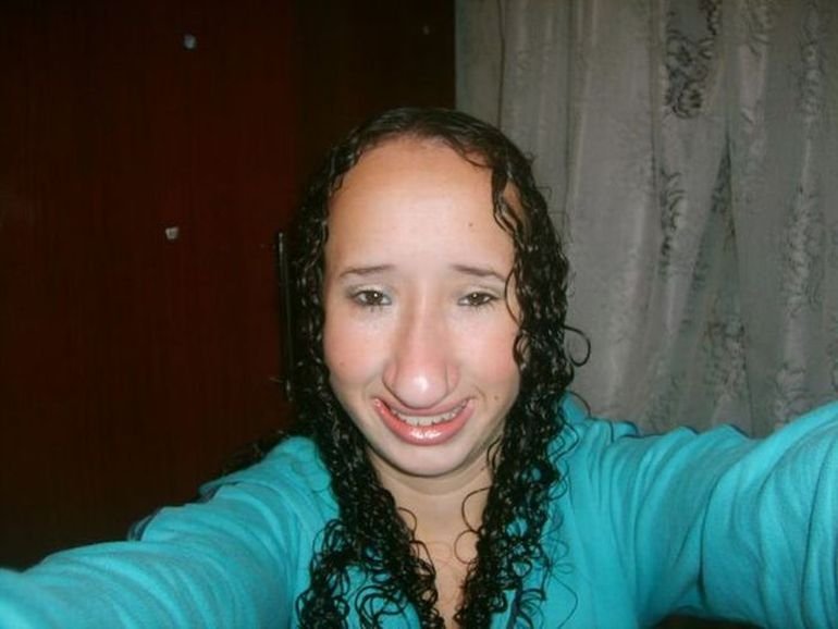 Огроменный нос у девушки