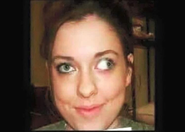 Косые глаза у девушки