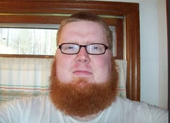 Жирный с бородой