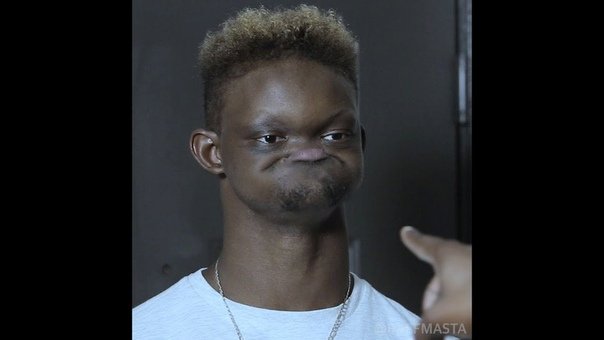 Афроамериканец с челюстью