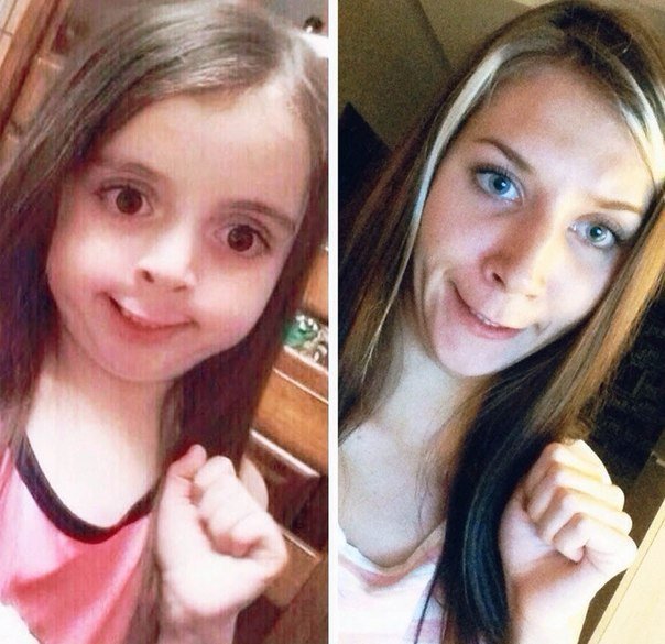 Мем девочка с зубами