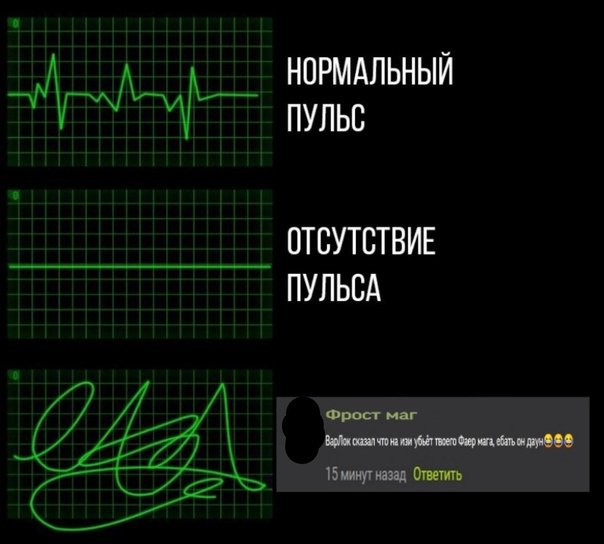 Нормальный пульс график