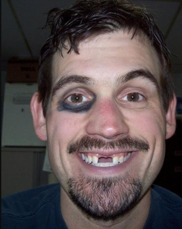 Чел без передних зубов