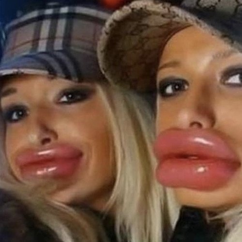 Губастые подруги