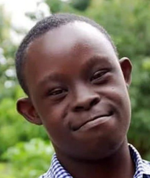 Черный ребенок с синдромом Дауна