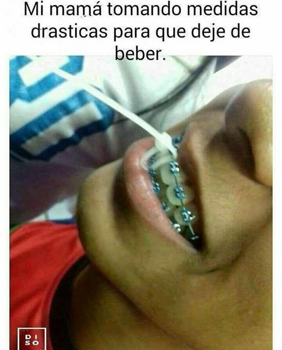 Шутки про брекеты в картинках