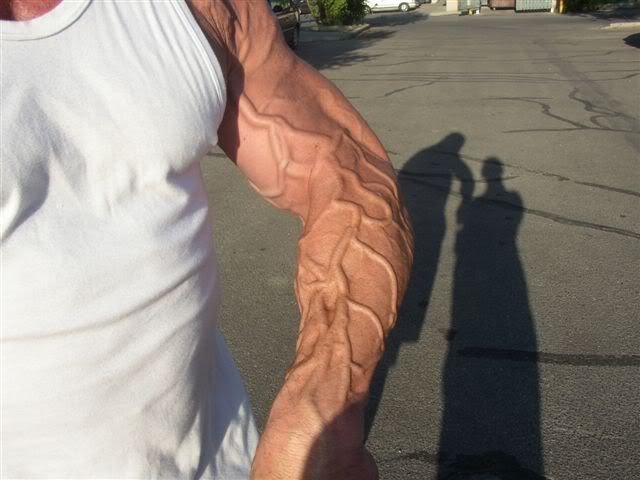 Очень большие вены на руках