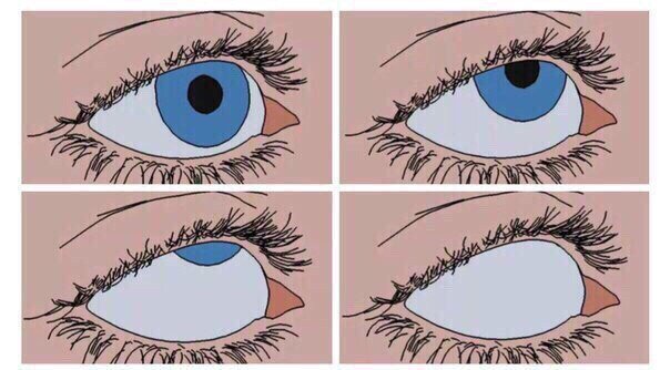 Глаза закатываются вверх