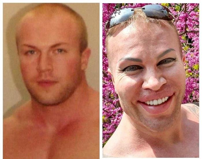 Шпак Александр до пластики