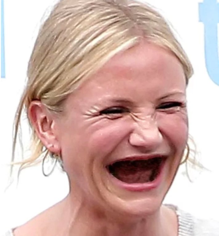 Девушка с зубами