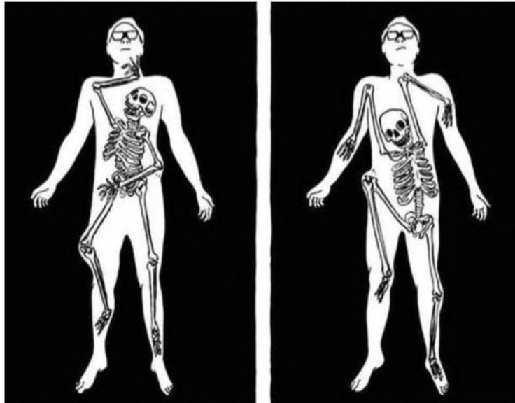 Скелет танцует внутри человека