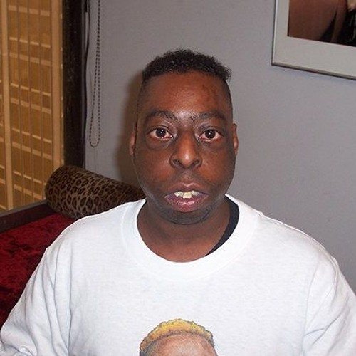 Карлик афроамериканец