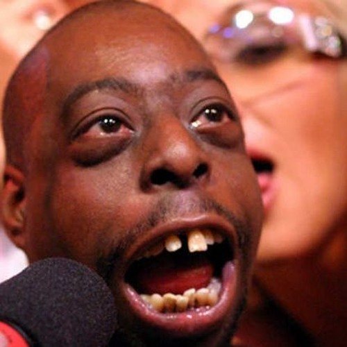 Афроамериканец с выпученными глазами