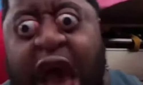 Парень свыпучеными глазами