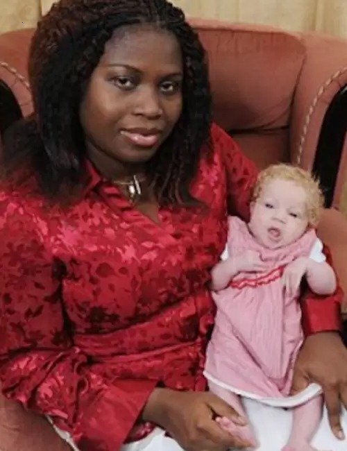 Африканка родила белого ребенка