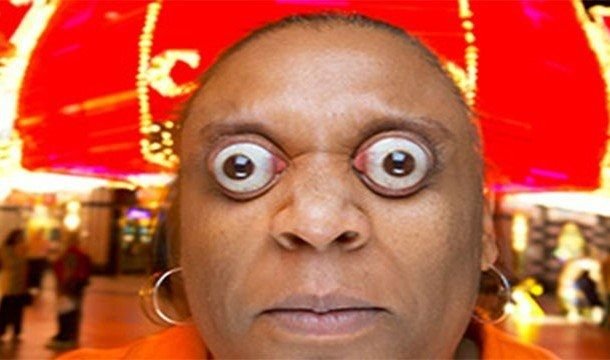 Лысый мужик с выпученными глазами