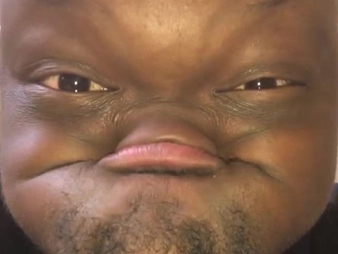 Негр без нижней челюсти