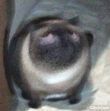 Пубертатная язва злодей британец