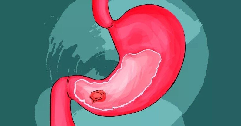 Желудок мультяшный