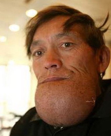 Самый большой подбородок