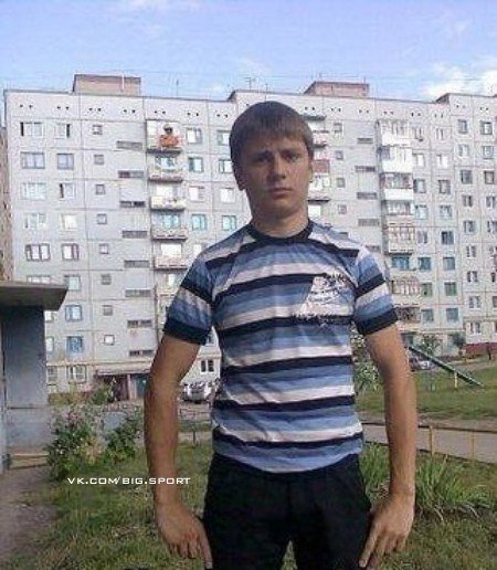 Синдром широкой спины