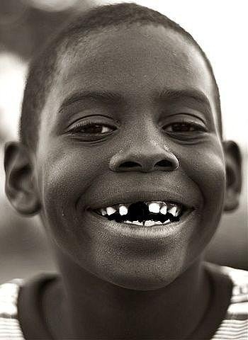 Беззубый негр улыбается