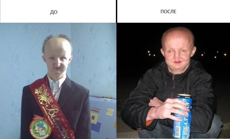 Долгоносик человек