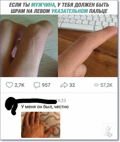 Шрам на левом указательном пальце