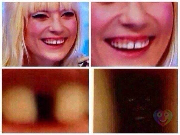 Негр между зубов