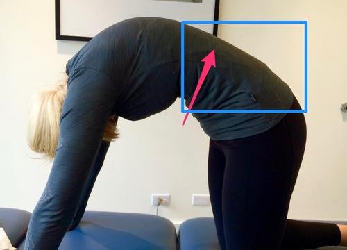 Выгнутая поясница