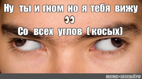 Косоглазие в разные стороны Мем