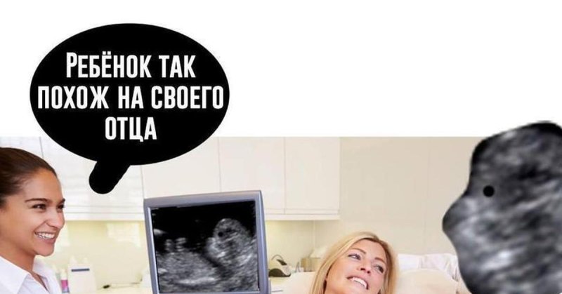 Мемы про УЗИ