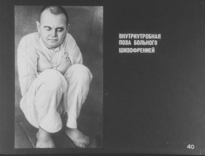 Поза больного шизофренией оригинал