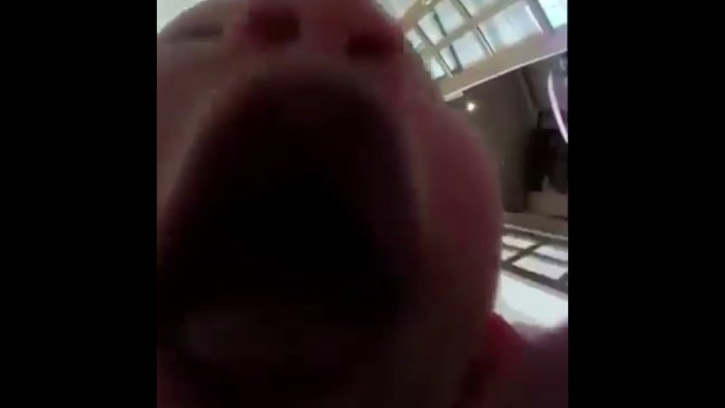 Ребёнок глотает камеру