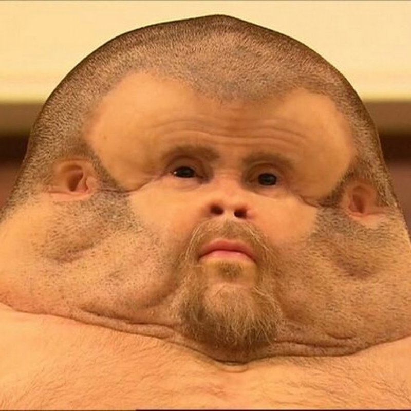 Толстое лицо мужчины