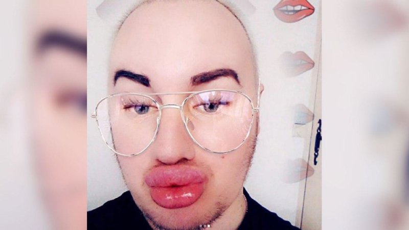 Пареньснакачеными губами